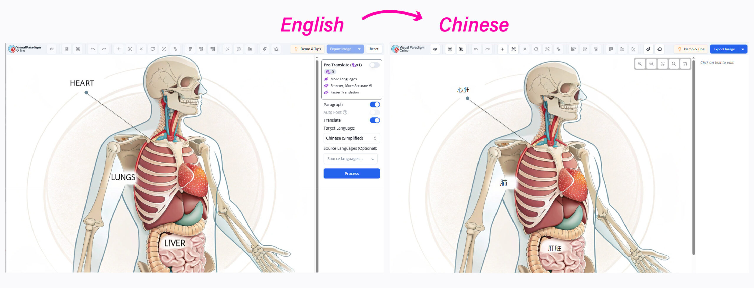 Medical diagram translation online
